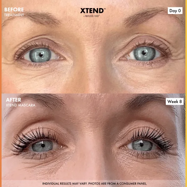 Before and After