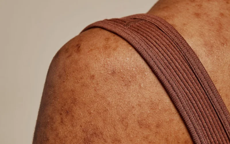 Close up of a woman’s shoulder in a sleeveless top.