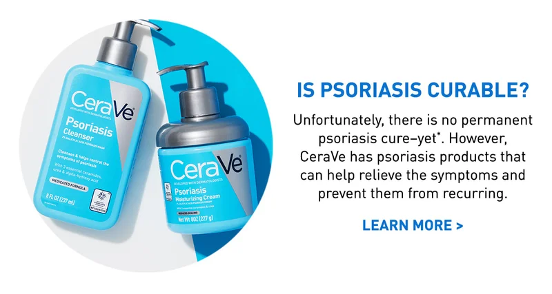 Is Psoriasis Curable?