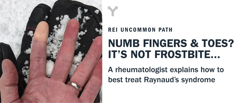 how to treat Raynaud's syndrome
