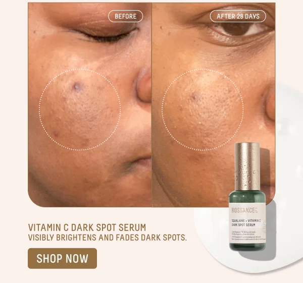 Vitamin C Dark Spot Serum