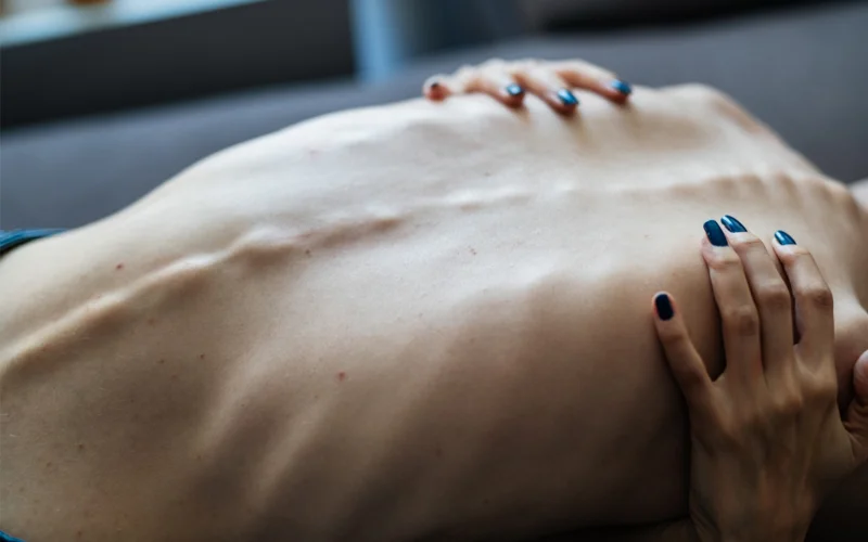 A photo of a person’s spine with two hands with blue nails clutching them from the front.