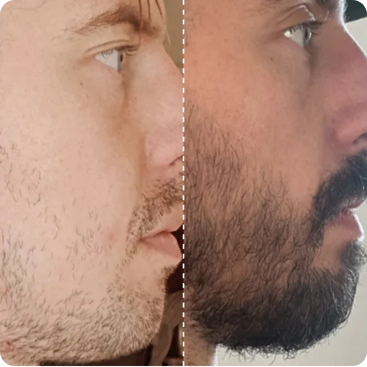 Image of Callums progress