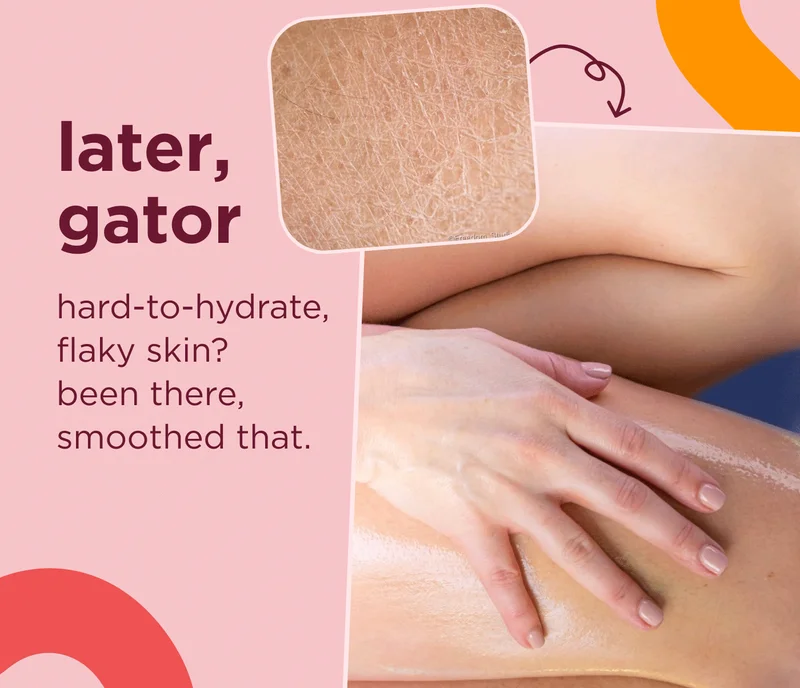 later, gator hard-to-hydrate, flaky skin? been there, smoothed that.