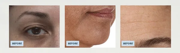 [GIF] Before & After images