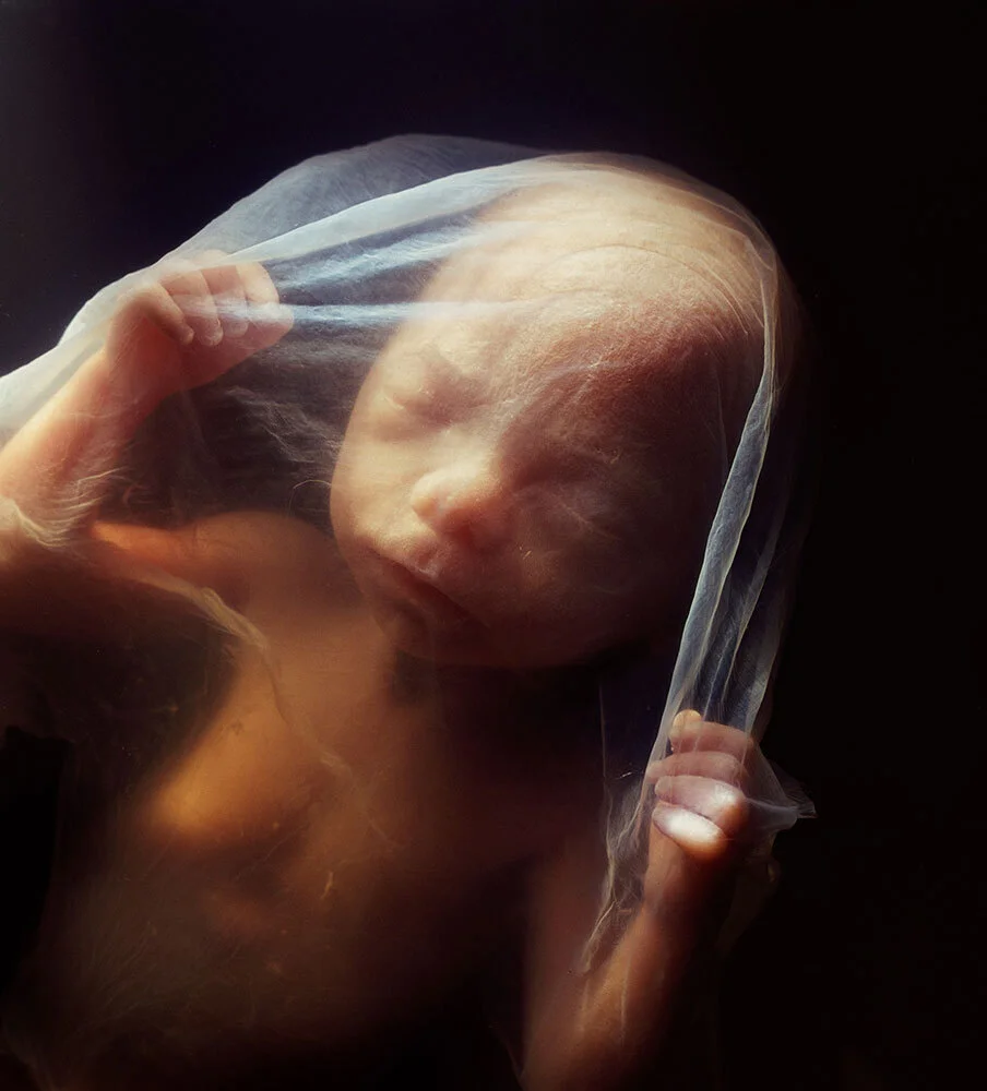 A human fetus floats in the amniotic sac at 18 weeks, receiving all the oxygen and nutrients it requires via the placenta.