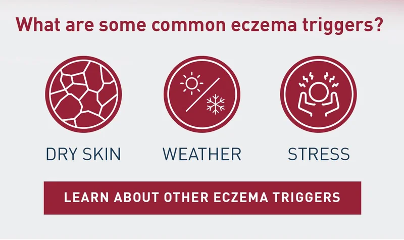 What are some common eczema triggers