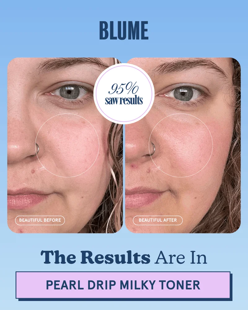 BLUME: The Results Are In - 95% saw results [PEARL DRIP MILKY TONER]