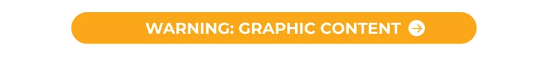 WARNING: GRAPHIC CONTENT