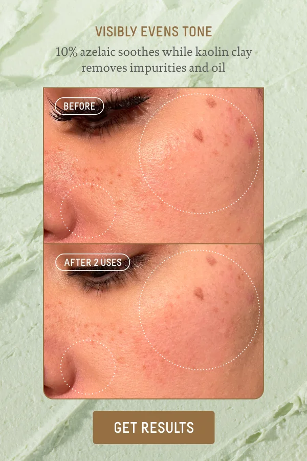 Visibly Evens Tone, 10% Azelaic Acid