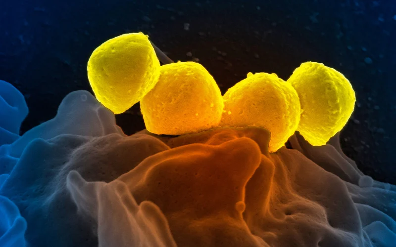 Colored scanning electron micrograph of Streptococcus pyogenes