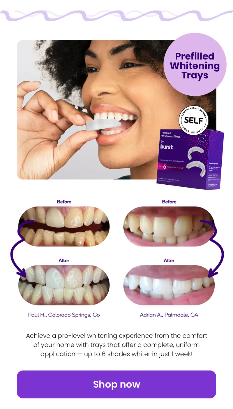 Prefilled Whitening Trays 7 pack