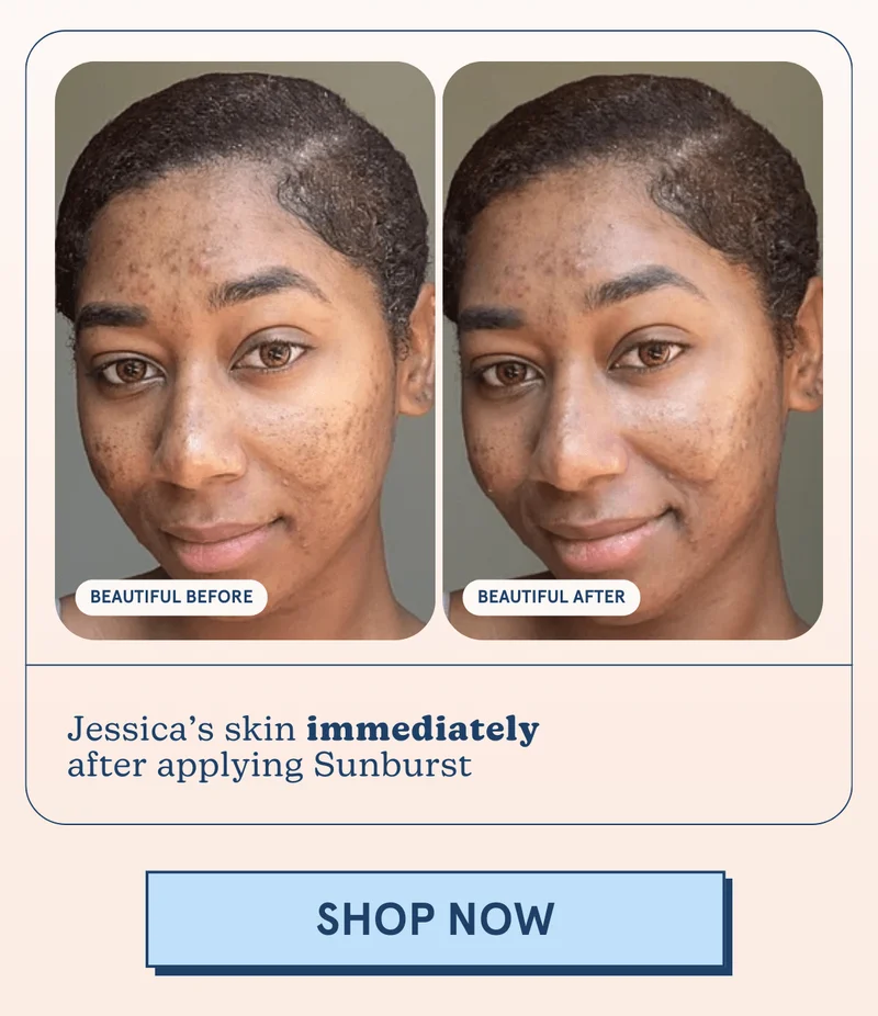 Jessica’s skin immediately after applying Sunburst