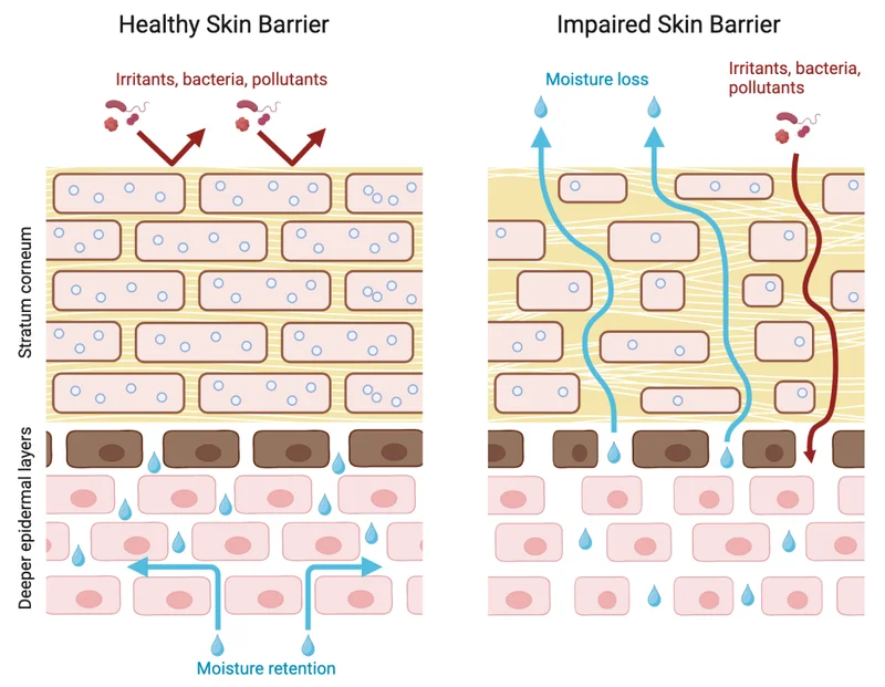 Healthy Skin Barrier | Impaired Skin Barrier