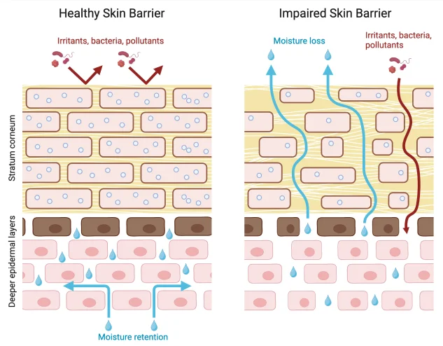 Healthy Skin Barrier | Impaired Skin Barrier