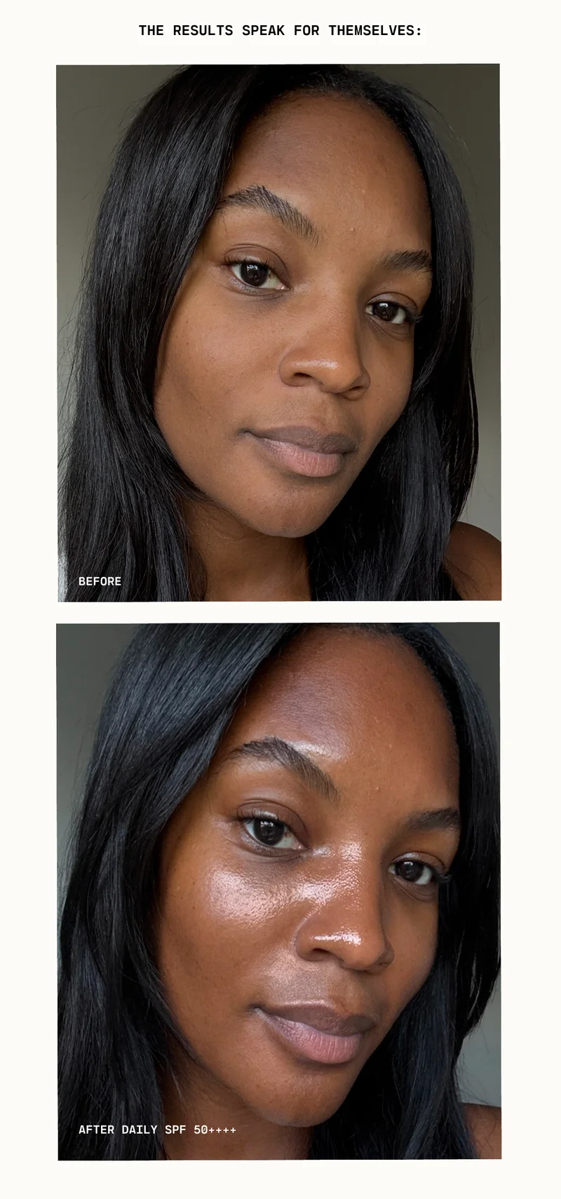 Before-After
