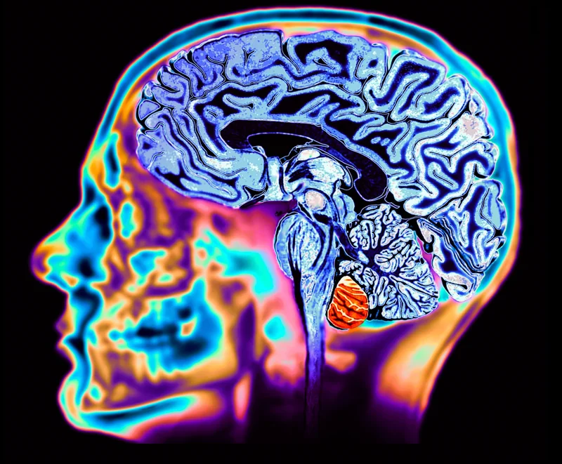 A close-up of a brain scan.