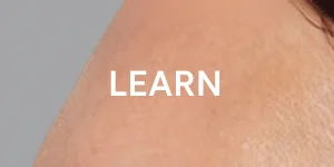 [Click here to LEARN MORE]