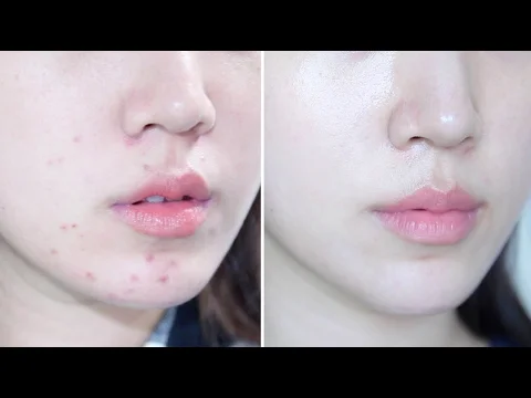 Before + After