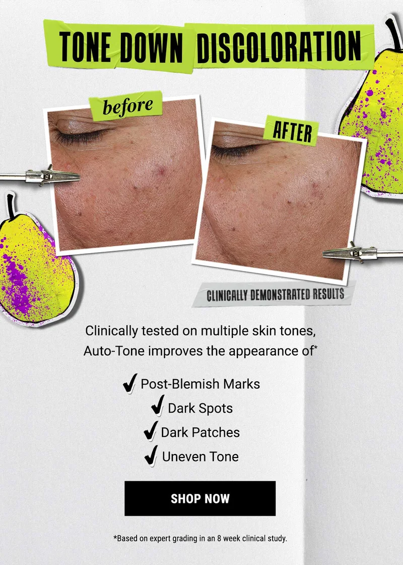 Tone Down Discoloration