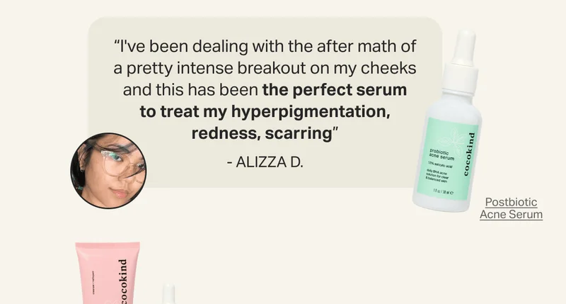 “I've been dealing with the after math of a pretty intense breakout on my cheeks and this has been the perfect serum to treat my hyperpigmentation, redness, scarring”