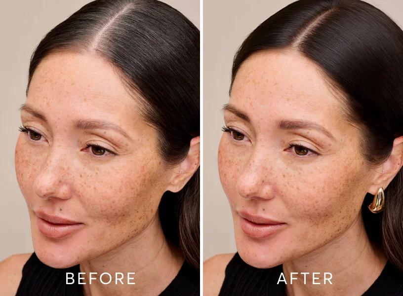 before & after