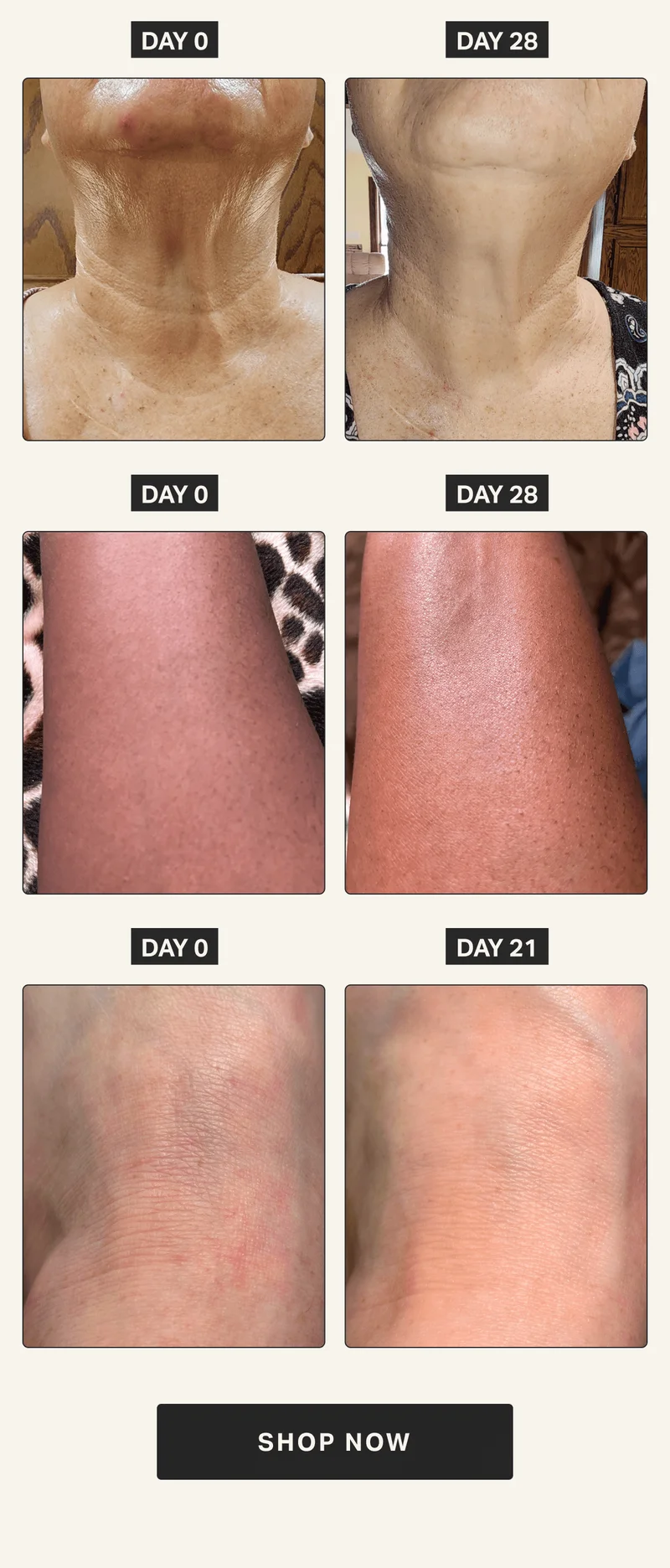 Retinol Body Cream SHOP FOR $22