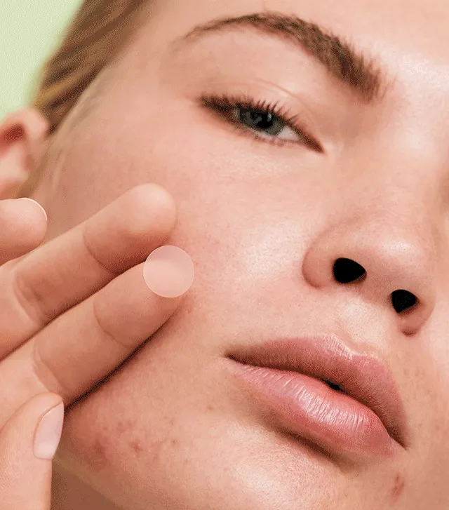 Blemish Breakthrough Stick It to Zits Pimple Patches