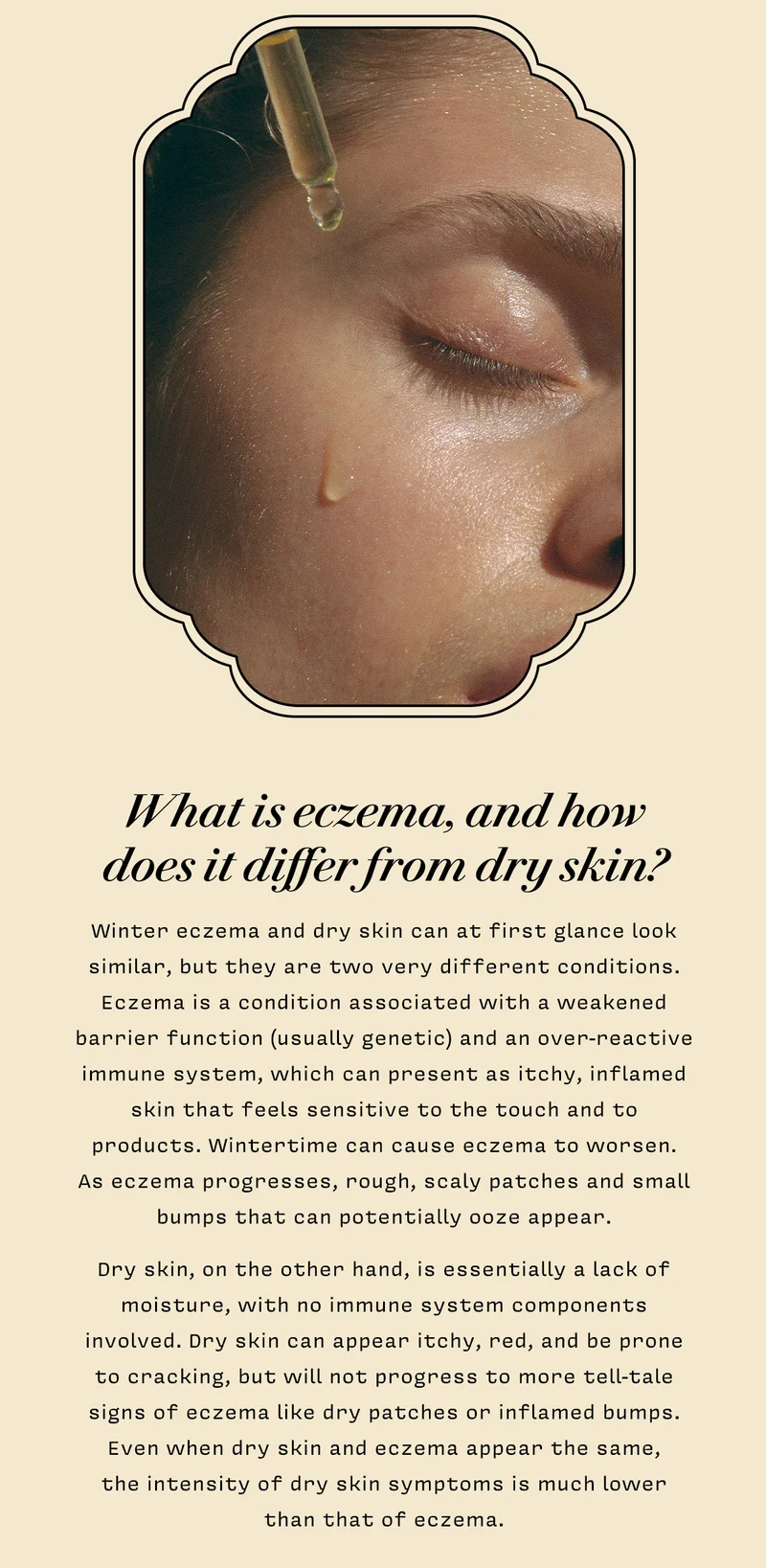 What is eczema, and how does it differ from dry skin? Winter eczema and dry skin can at first glance look similar, but they are two very different conditions. Eczema is a condition associated with a weakened barrier function (usually genetic) and an over-reactive immune system, which can present as itchy, inflamed skin that feels sensitive to the touch and to products. Wintertime can cause eczema to worsen. As eczema progresses, rough, scaly patches and small bumps that can potentially ooze appear.    Dry skin, on the other hand, is essentially a lack of moisture, with no immune system components involved. Dry skin can appear itchy, red, and be prone to cracking, but will not progress to more tell-tale signs of eczema like dry patches or inflamed bumps. Even when dry skin and eczema appear the same, the intensity of dry skin symptoms is much lower than that of eczema.