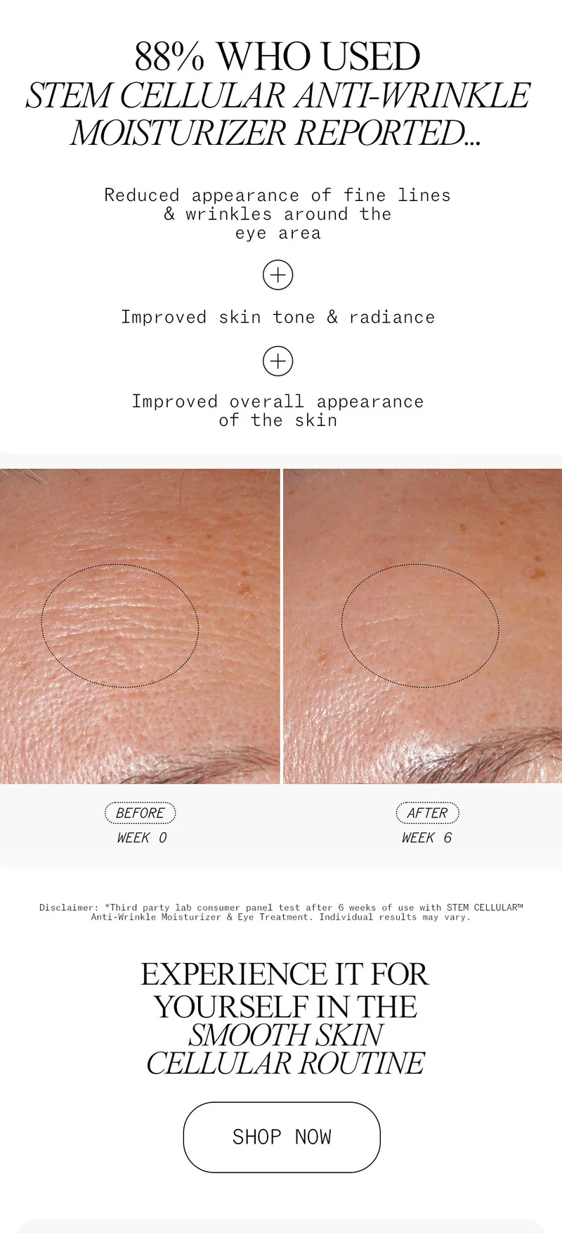 Experience Clinically Validated Results with Stem Cellular Anti-Wrinkle Moisturizer in the Smooth Skin Cellular Routine