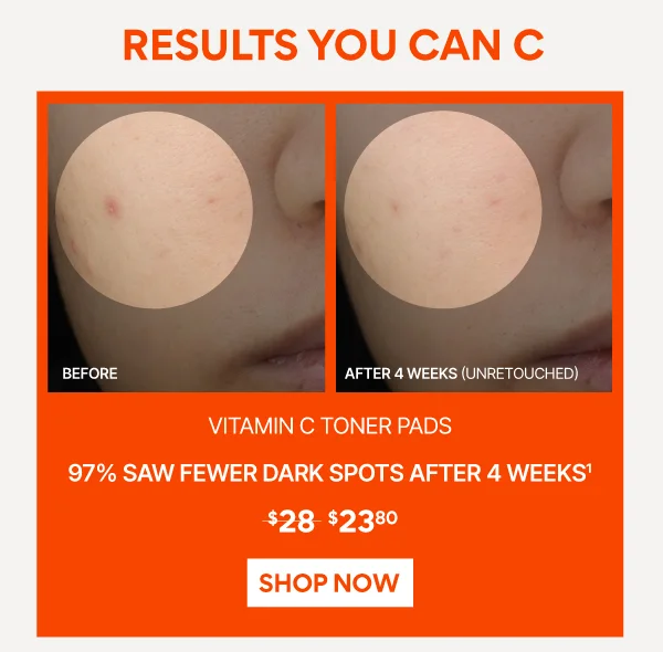 Green Tea Enzyme Vitamin C Brightening Toner Pads
