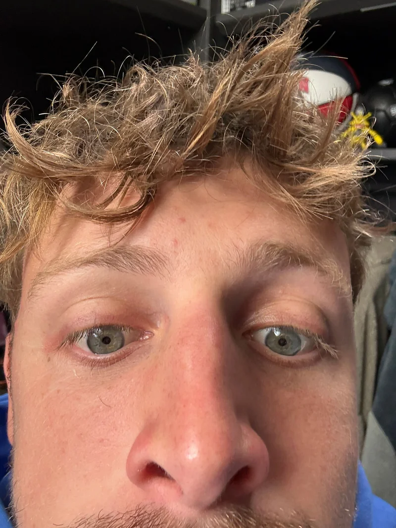 Harry Selfie