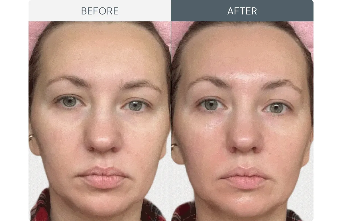 Before & After Showcase