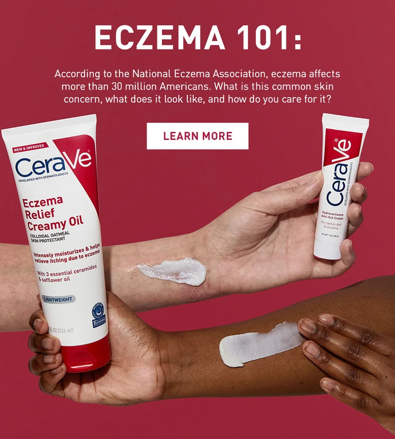 Eczema 101