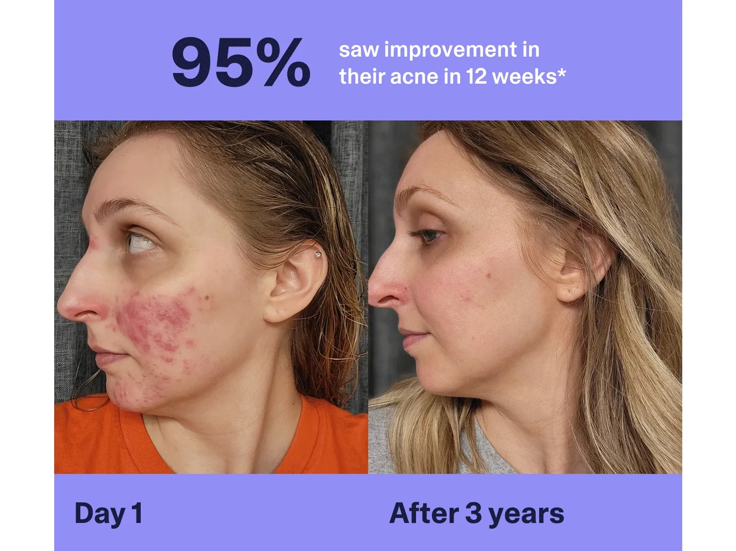 Before and after