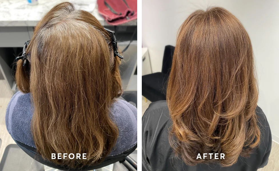 Before + After