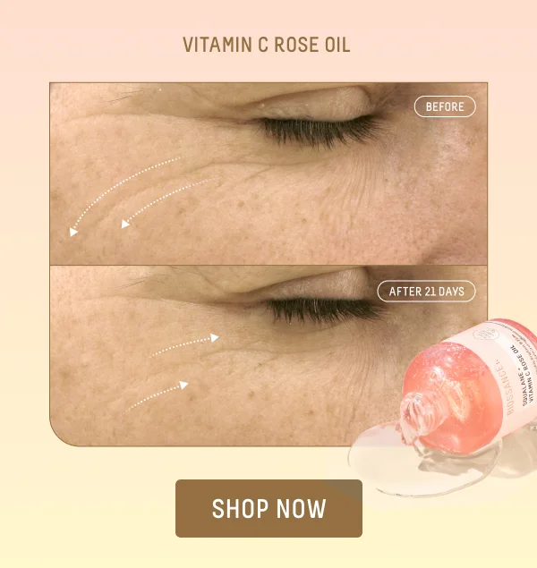 Vitamin C Rose Oil