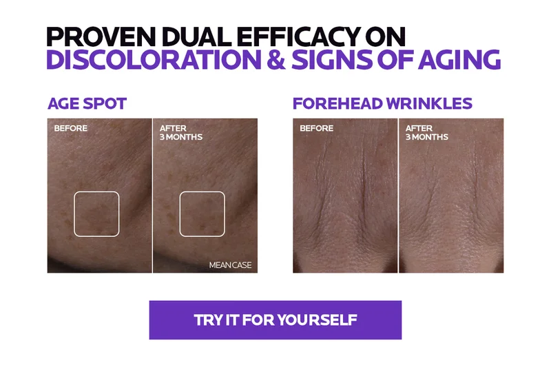 See the results of our new Mela B3 Double Dose