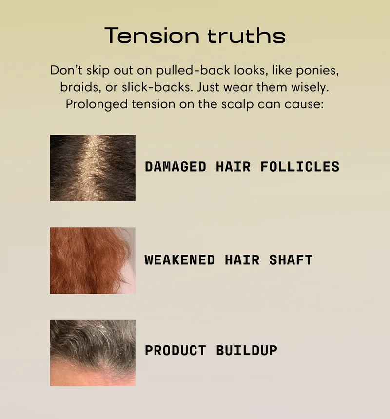 Tension truths | Don’t skip out on pulled-back looks, like ponies, braids, or slick-backs. Just wear them wisely. Prolonged tension on the scalp can cause: | Damaged hair follicles | Weakened hair shaft | Product buildup