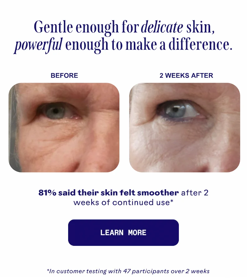 Before & after image. Learn more.