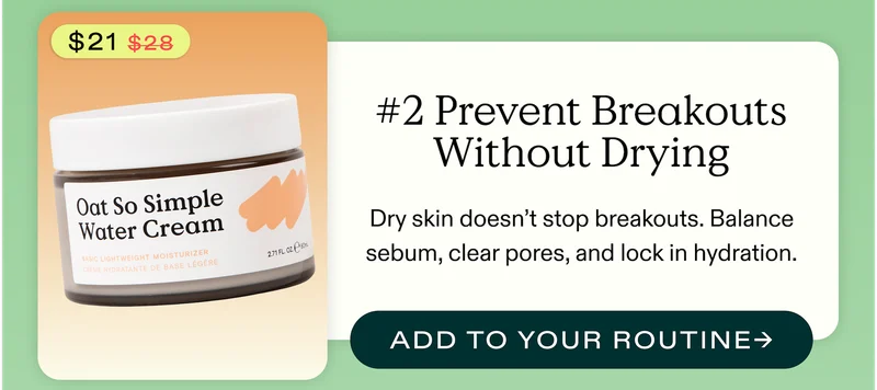 #2 Prevent Breakouts Without Drying