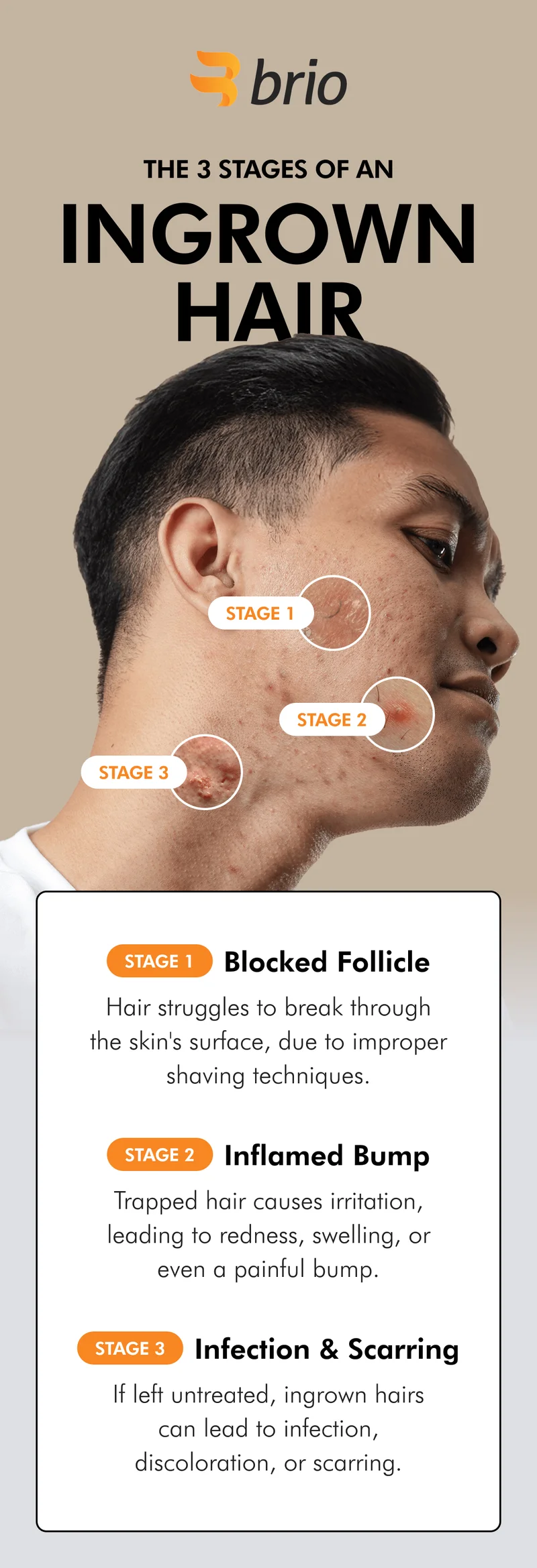 The fix to ingrown hairs.