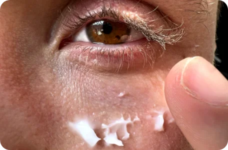 Skin Care
