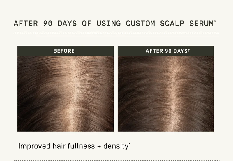 After 90 days of using Custom Scalp Serum