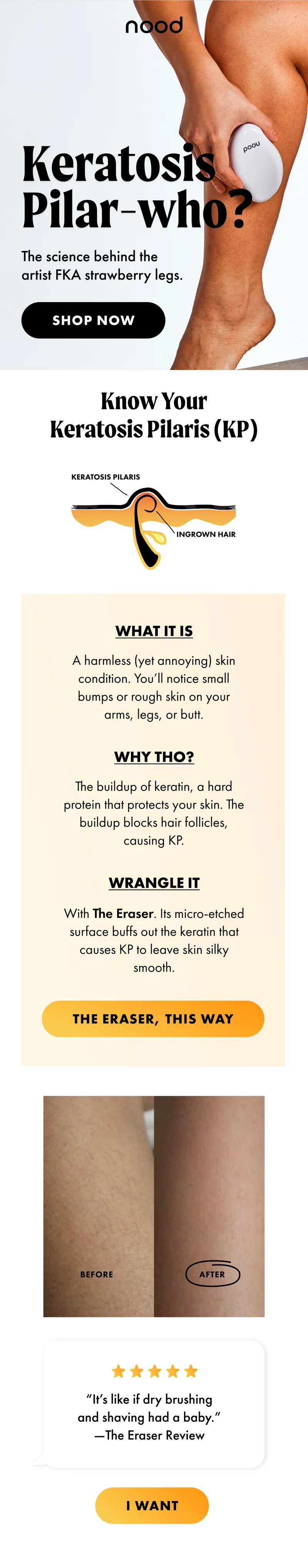 Keratosis Pilar-who? The science behind the artist FKA strawberry legs. Shop now. Know your keratosis pilaris (KP). The Eraser, This Way. Before and After photo. I want