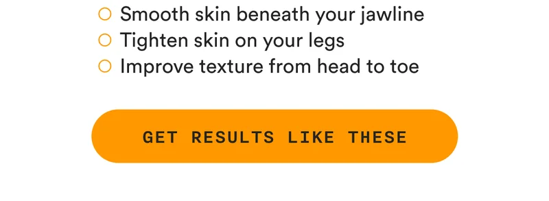 Smooth skin beneath your jawline, Tighten skin on your legs, Improve texture from head to toe - GET RESULTS LIKE THESE