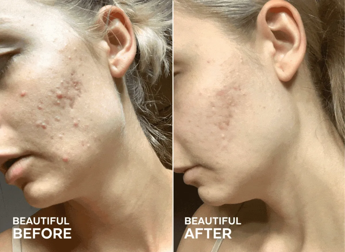 Beautiful Before | Beautiful After