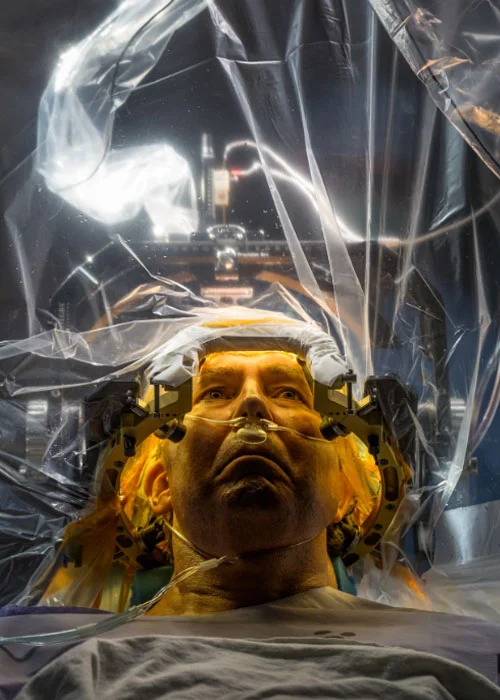 At the University of Florida, Parkinson’s disease patient Russell Price undergoes surgery to implant a deep brain stimulation (DBS) lead that will deliver electrical impulses to motion-controlling parts of his brain.