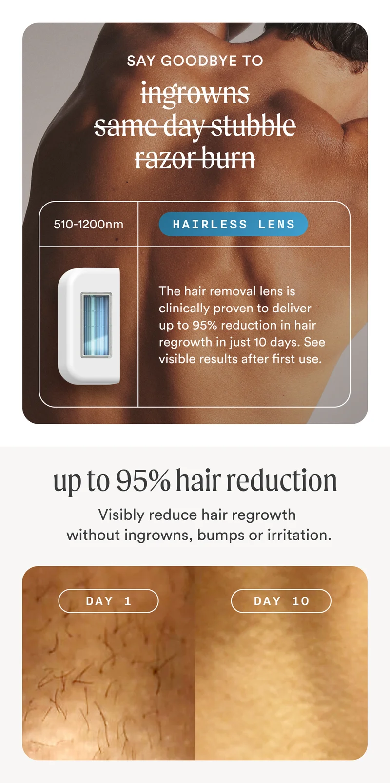 say goodbye to ingrowns same day stubble razor burnthe world's first IPL with interchangeable lenses