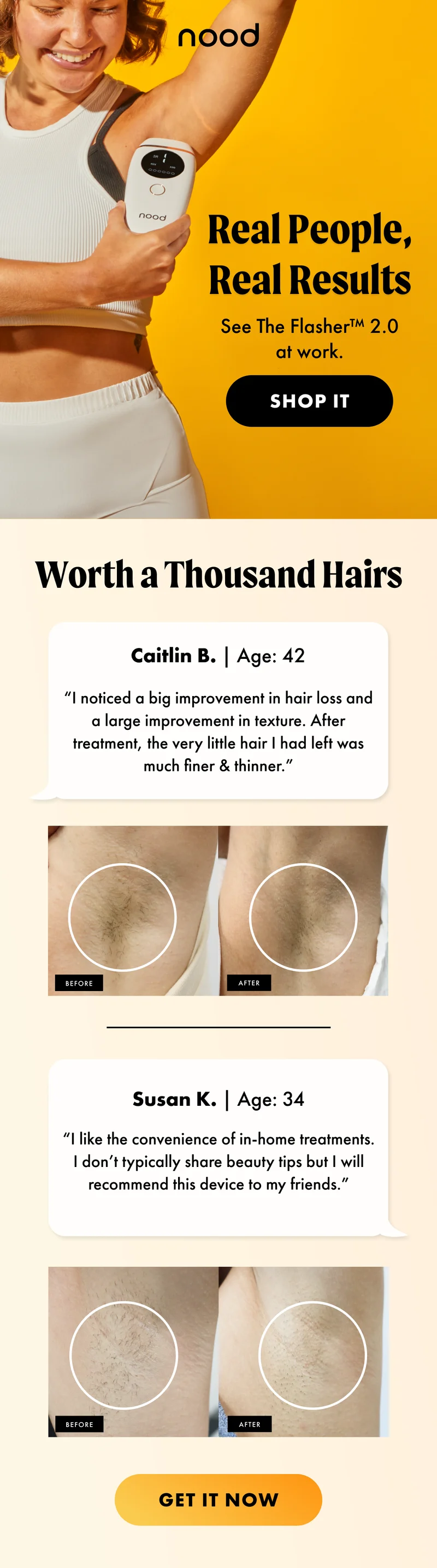 H1: Real People, Real Results S1: See The Flasher™ 2.0 at work. CTA1: SHOP IT H2: Worth a Thousand Hairs S2: Caitlin B. | Age: 42 “I noticed a big improvement in hair loss and a large improvement in texture. After treatment, the very little hair I had left was much finer & thinner.” [Before/After asset] Susan K. | Age: 34 “I like the convenience of in-home treatments. I don’t typically share beauty tips but I will recommend this device to my friends.” [Before/After asset] CTA2: GET IT NOW